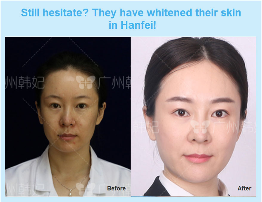 Skin Beauty Skin Rejuvenation Skin Whitening Plastic Surgery