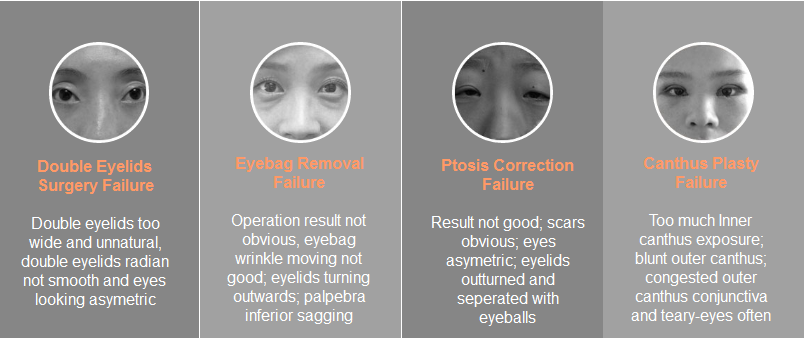 eye plasty revision