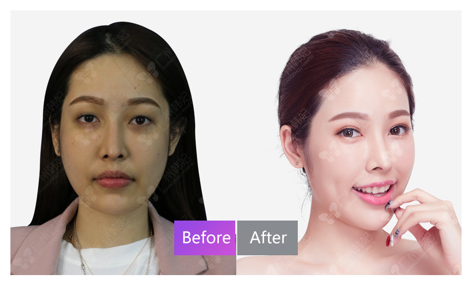 cosmetic surgeries or non-invasive treatments photos