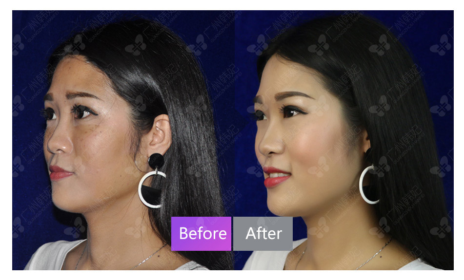 cosmetic surgeries or non-invasive treatments photos