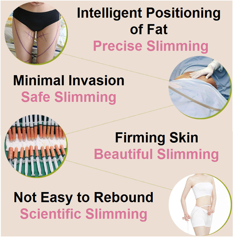 hanfei liposuction in china, face,neck,waist,abdomen,back,arms, legs cost 5000-20000rmb